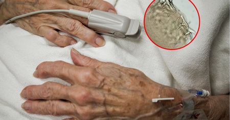 Zgłosił się z silnym bólem głowy. Zamiast guza, wykryli "pasażera" na gapę