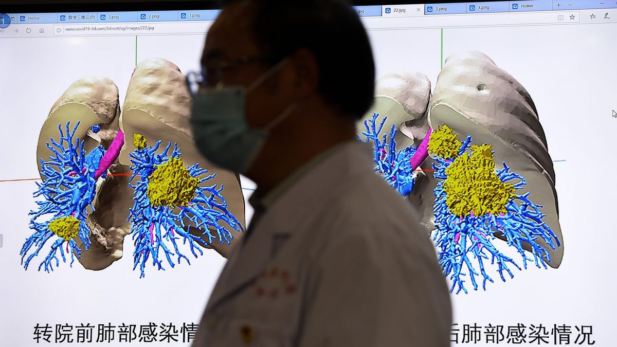 Frank Ruschitzka, lekarz ze Szwajcarii, wyjaśnia, jak koronawirus doprowadza do niewydolności wielonarządowej