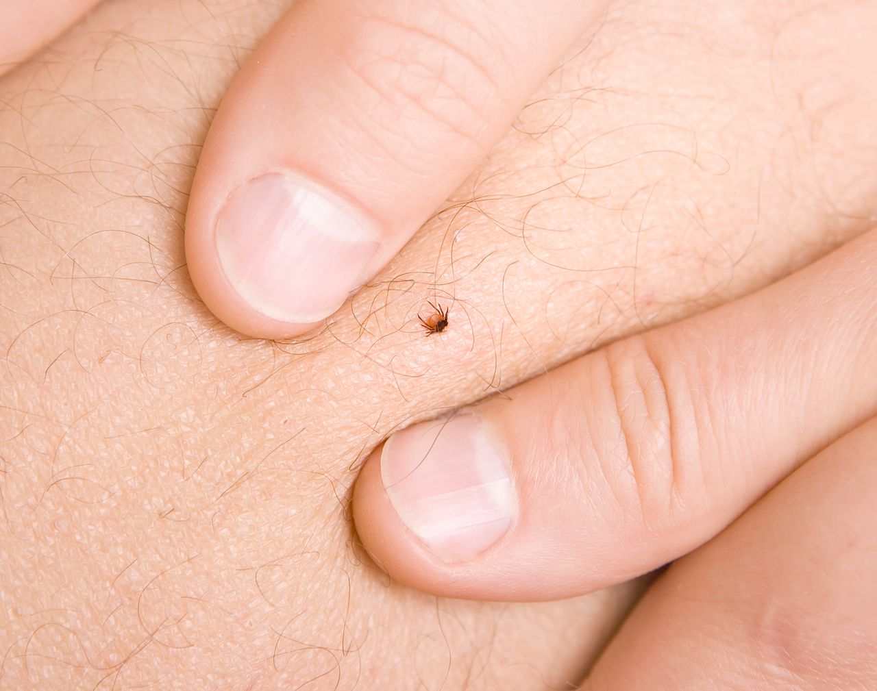 Natural tick remedy: protect your summer outings