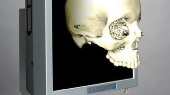 Medyczny ekran 3D kontrolowany gestami 1