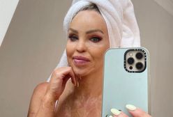 Katie Piper usłyszała od córki: "Wyglądasz przerażająco". Zaczęła płakać