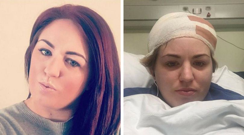 29-latka chciała zrobić sobie fryzurę ''jednorożca''. Straciła połowę włosów na głowie