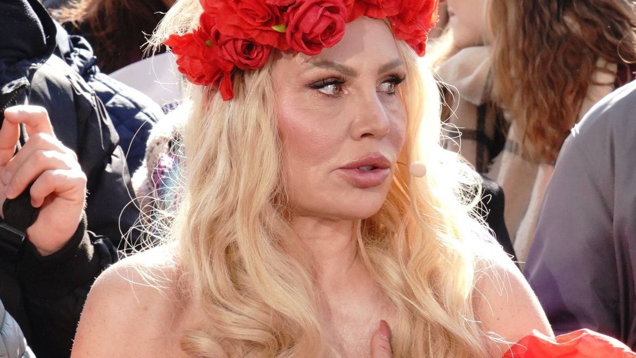 Monika Jarosińska przeżyła dramat po operacji kręgosłupa. "Nie chodziłam przez TRZY MIESIĄCE"