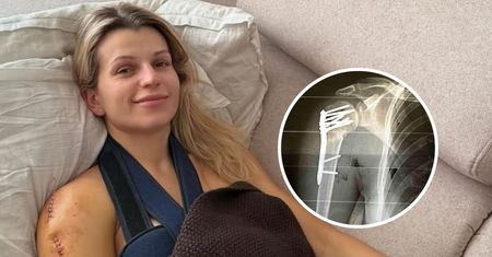Dziennikarka "Dzień Dobry TVN" miała poważny wypadek. "Coraz bardziej miażdżył i łamał moją rękę"