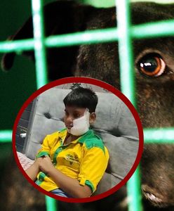 Atak pitbulla na dziecko. Potrzebnych było 150 szwów