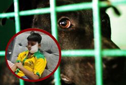 Atak pitbulla na dziecko. Potrzebnych było 150 szwów