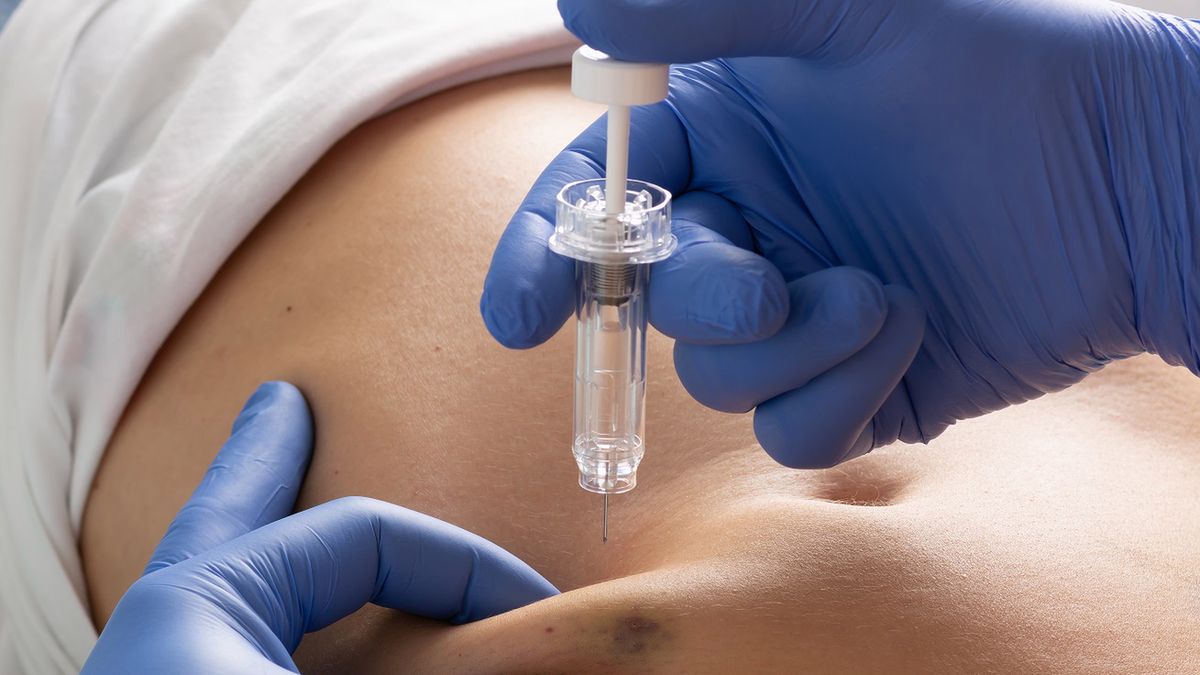 Jedną z przyczyn powstawania skrzepów u chorujących na COVID jest tzw. nadmierna lepkość krwi