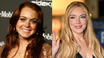 Twarz Lindsay Lohan wyraźnie ewoluowała. Lekarz medycyny estetycznej WYLICZYŁ zabiegi, jakim się poddała