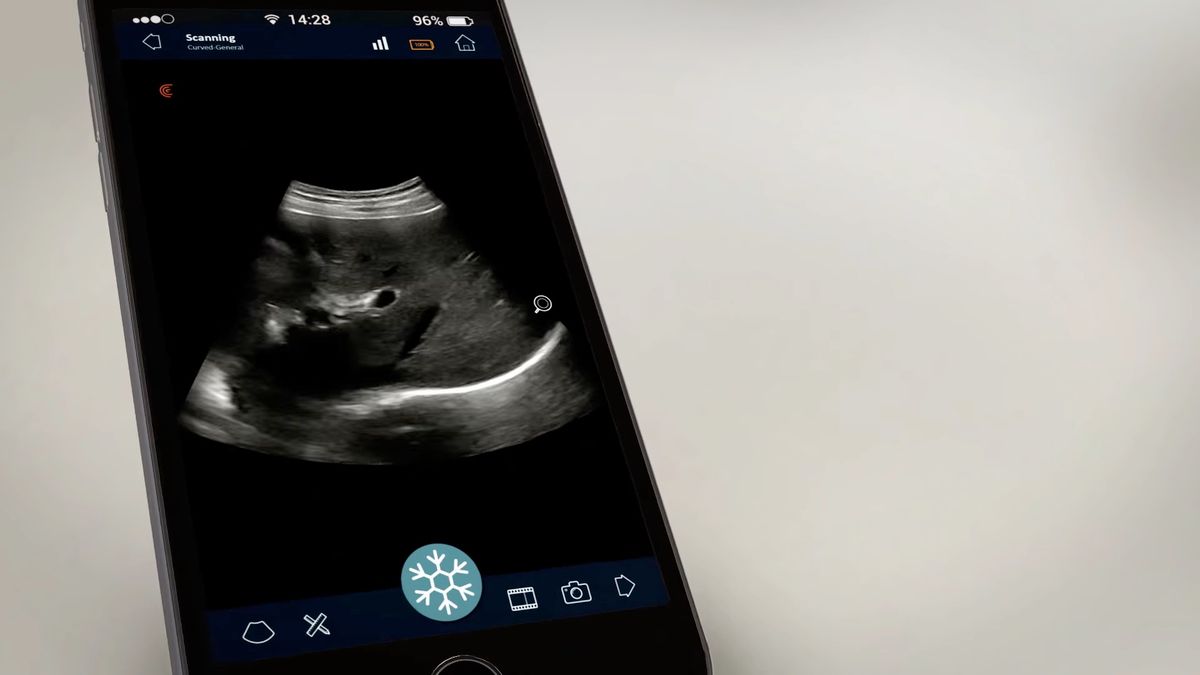 Przenośny ultrasonograf dla smartfonów to sprzęt, o którym marzą lekarze? Pytamy jednego z nich 1