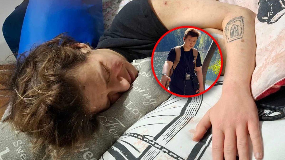 Maksym Pisarczyk ma rzadką mutację genetyczną.