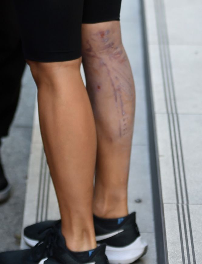 Nicole Scherzinger