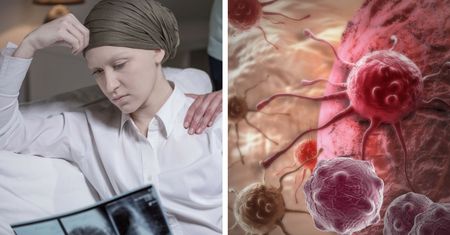 Alternatywne sposoby leczenia raka? Ekspert wyjaśnia i ostrzega