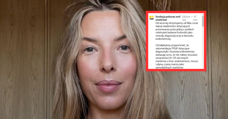 Lekarze przeciwko Chodakowskiej. "Chciwość celebrytów nie zna granic"