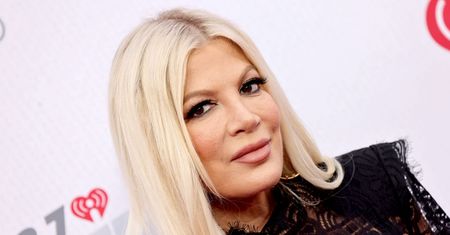 Tori Spelling bolało oko. Diagnoza ją przeraziła