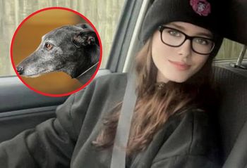 19-latka zagryziona przez psa. Wiadomo, co wykazała sekcja zwłok