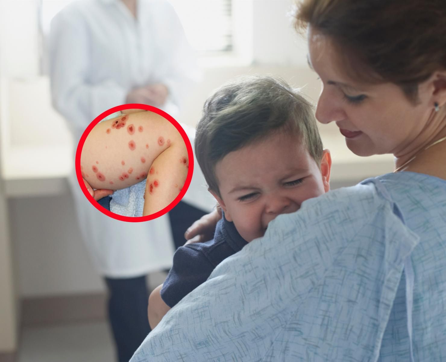 Na ciele dwulatka nagle pojawiły się czerwone plamy. To był objaw rzadkiej choroby