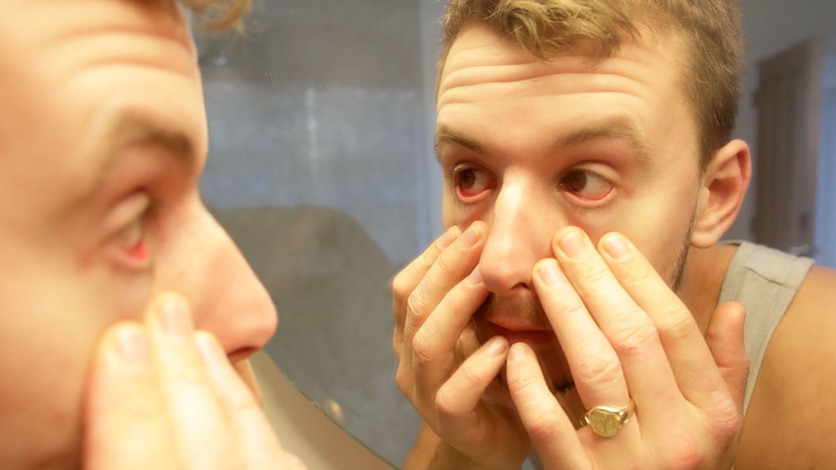 Man looking into eyes in mirror
Peter Cade
health, check, wrinkles, young man, bloodshot, check up, concern, suffering, man flu, mens health, feeling sick, sickness, palour, pale, concerned