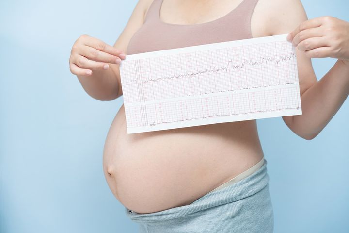 Jedną z metod monitorowania akcji serca dziecka jest kardiotokografia