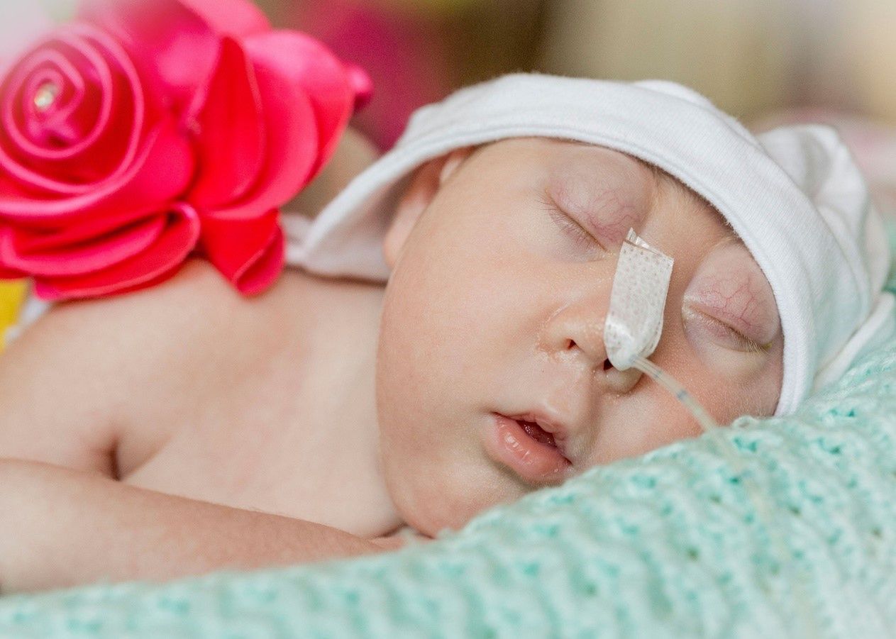 Marcelinka Podopieczna Hospicjum Pomorze Dzieciom/Fot. Michalina Krause