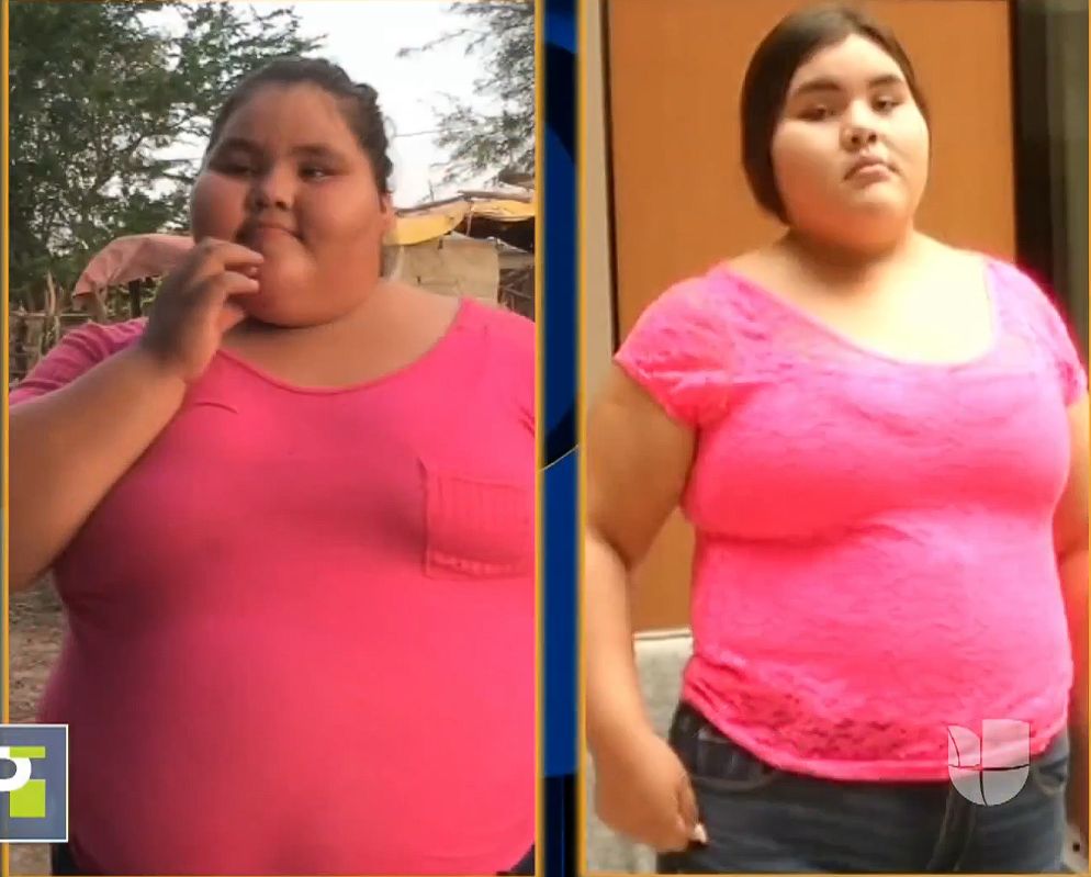 Dayana Camacho przed i po