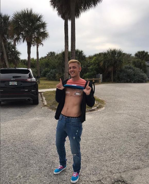 Komik na operację czekał dekadę