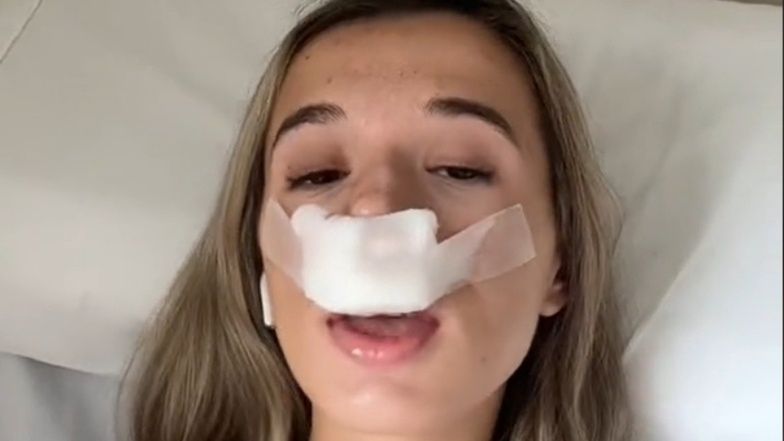 Influencerka poddała się operacji, by jej "dzieci urodziły się z ładnymi nosami". Internauci nie dowierzają: "W jakim świecie ona żyje?"