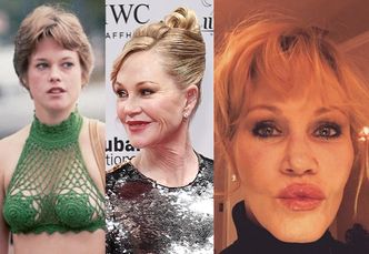 Melanie Griffith ŻAŁUJE OPERACJI PLASTYCZNYCH: "Poszłam do innego lekarza, który zaczął odwracać efekty tego gów*a"