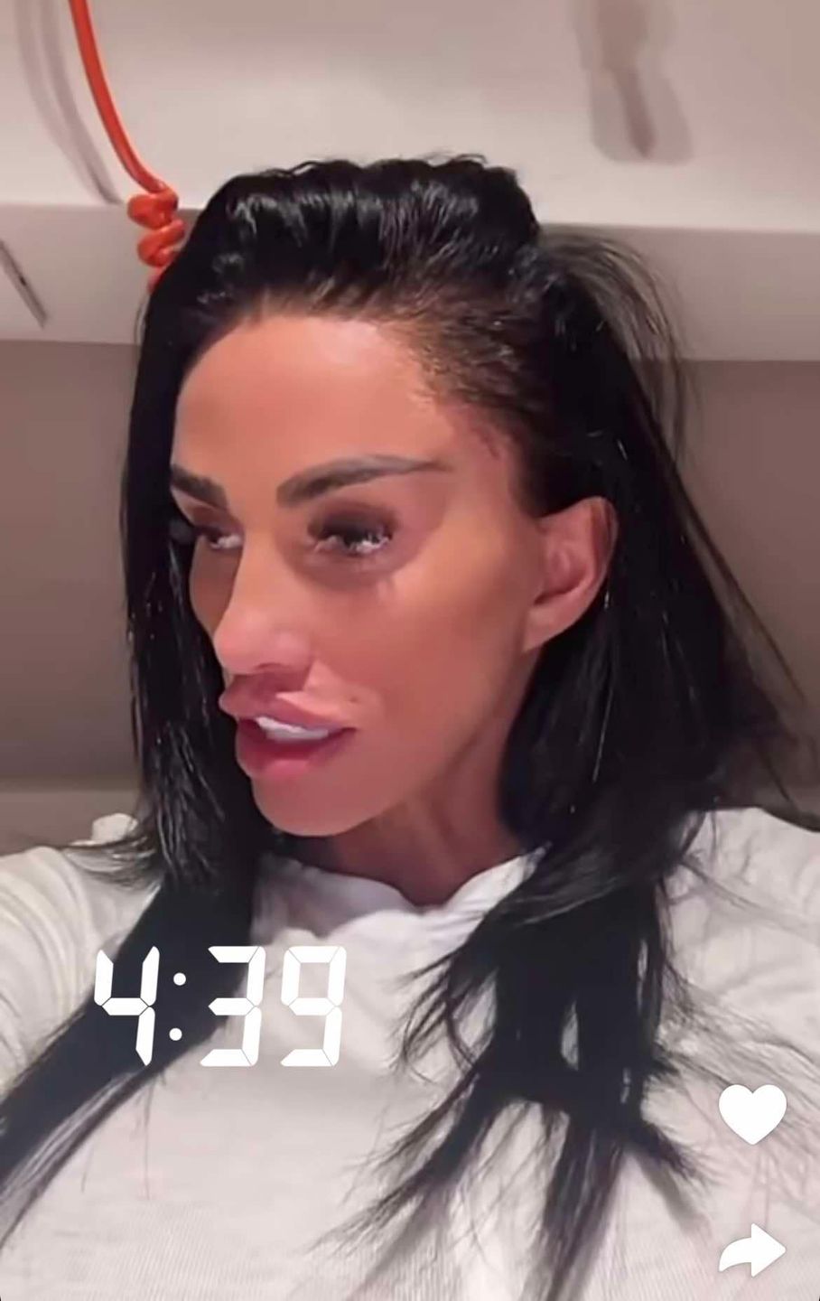 Katie Price prezentuje kulisy kolejnej operacji w Turcji