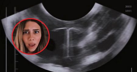 Ogromna pomyłka podczas USG. Lekarz zobaczył spiralę
