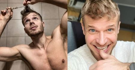 "Odmieniony" Tomasz Ciachorowski wspomina PRZESZCZEP WŁOSÓW: "Byłem znieczulony i cały czas świadomy"