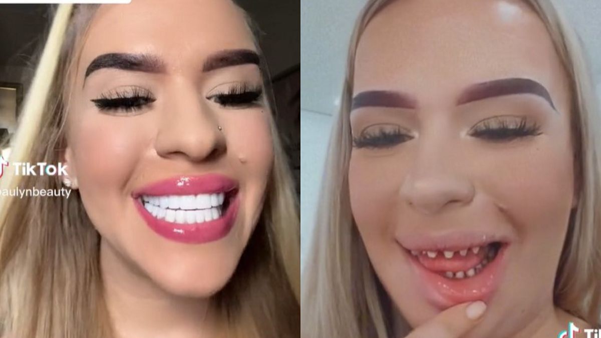 Polka zrobiła sobie "tureckie zęby". Jest zachwycona z efektów. 