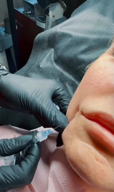 Dominika Tajner pokazała nagranie z zabiegu