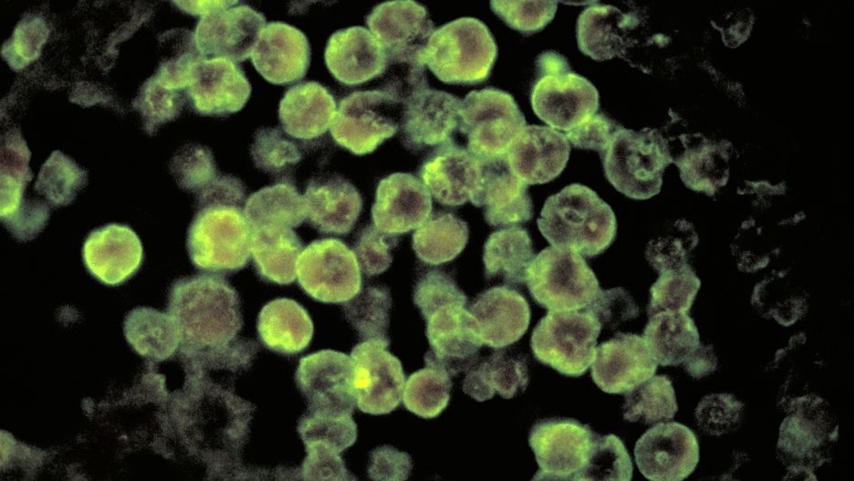 Bakteria Naegleria fowleri
