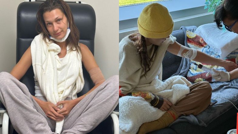 Bella Hadid ma boreliozę