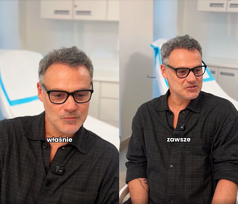 Jan Wieczorkowski przeszedł przeszczep włosów