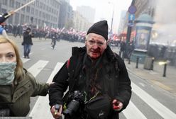 Marsz Niepodległości. Legendarny fotoreporter Tomasz Gutry poważnie zraniony