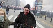 Marsz Niepodległości. Legendarny fotoreporter Tomasz Gutry poważnie zraniony