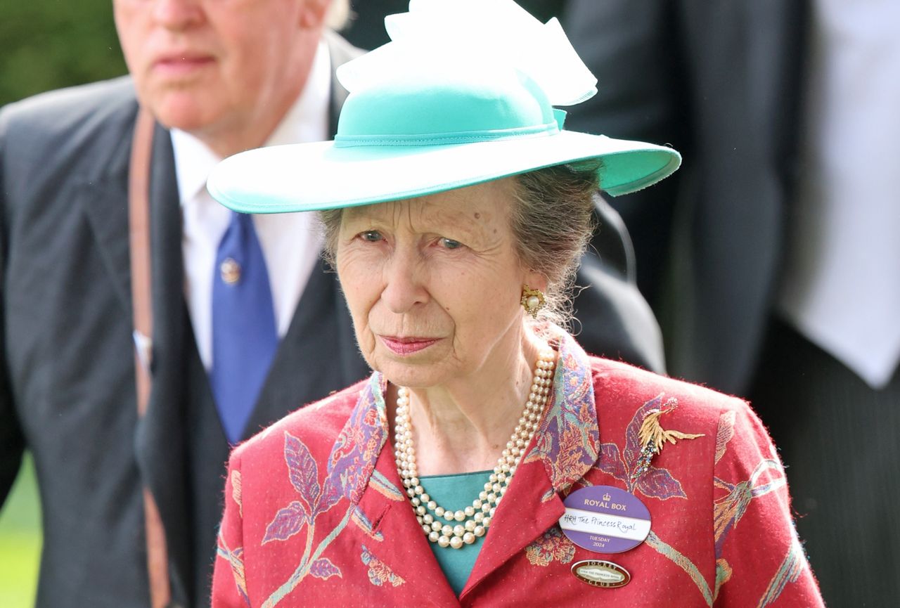Princess Anne hospitalized after a severe horse accident