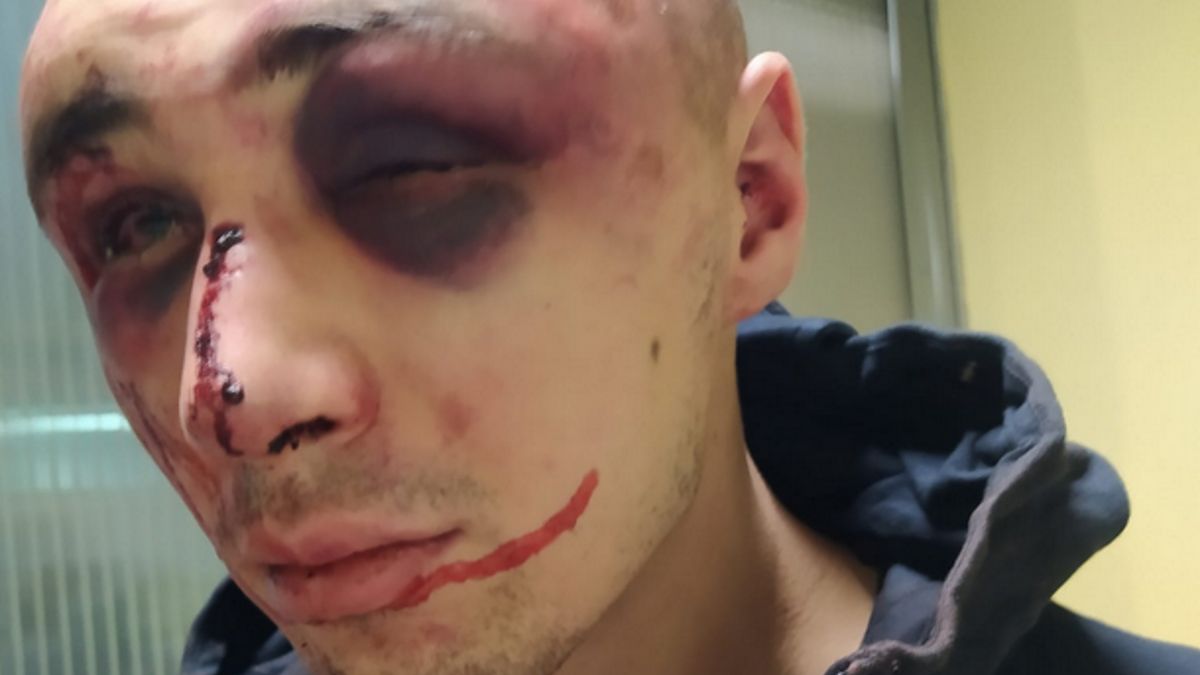 Na dworcu w Morągu (woj. warmińsko-mazurskie) doszło do brutalnego pobicia i napadu. 