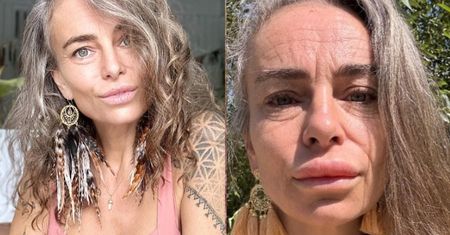 Kasia Nast prezentuje efekty wstrzyknięcia sobie JADU ŻABY i odpływa: "Życie w dyskomforcie, piękne procesy..." (FOTO)