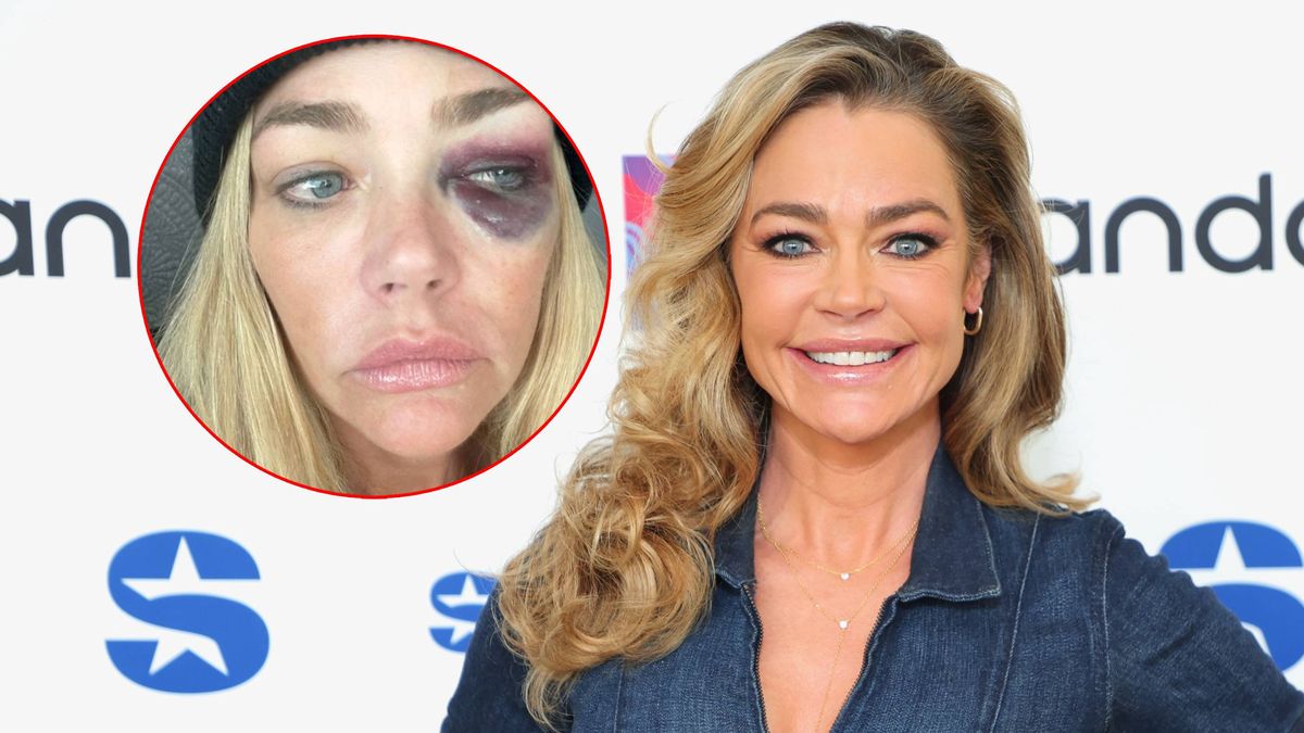 Denise Richards