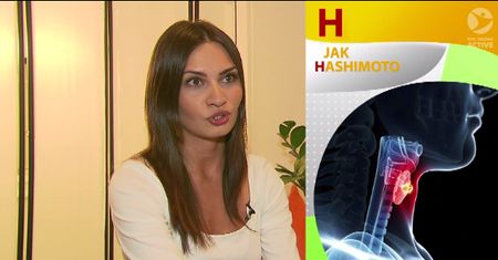 Czym jest choroba Hashimoto i jakie znaczenie ma dieta chorego?
