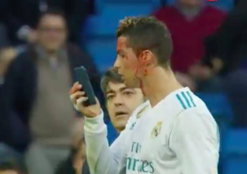 Ronaldo miał wypadek podczas ostatniego meczu