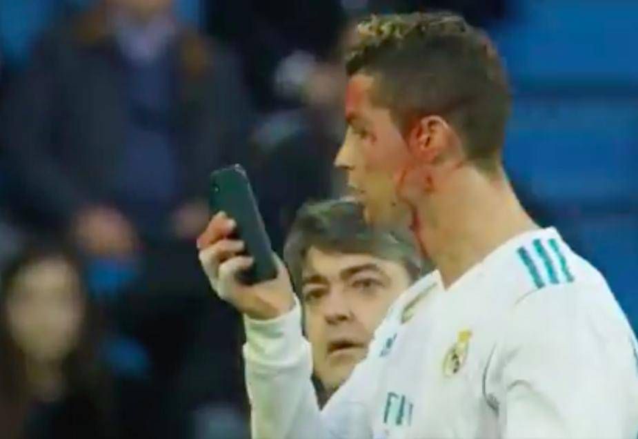 Ronaldo miał wypadek podczas ostatniego meczu