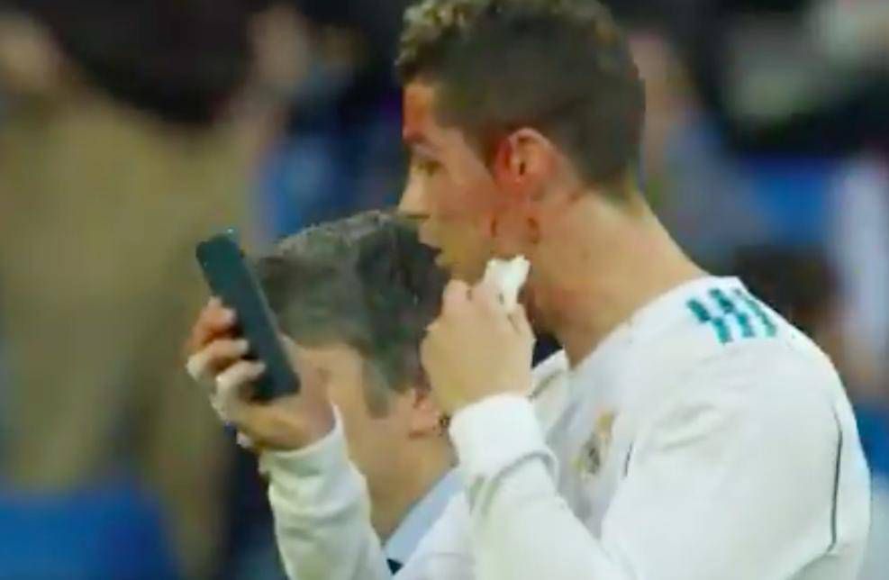 Ronaldo miał wypadek podczas ostatniego meczu
