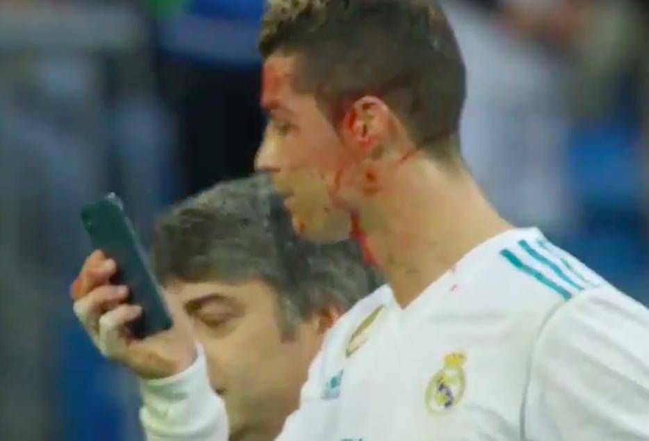 Ronaldo miał wypadek podczas ostatniego meczu