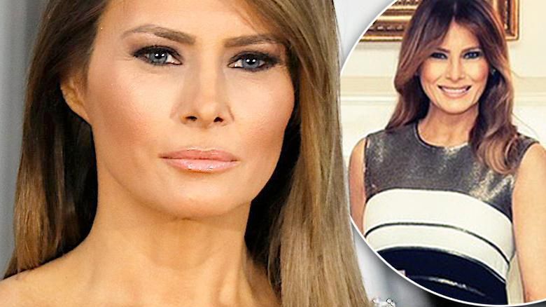 Melania Trump po operacji
