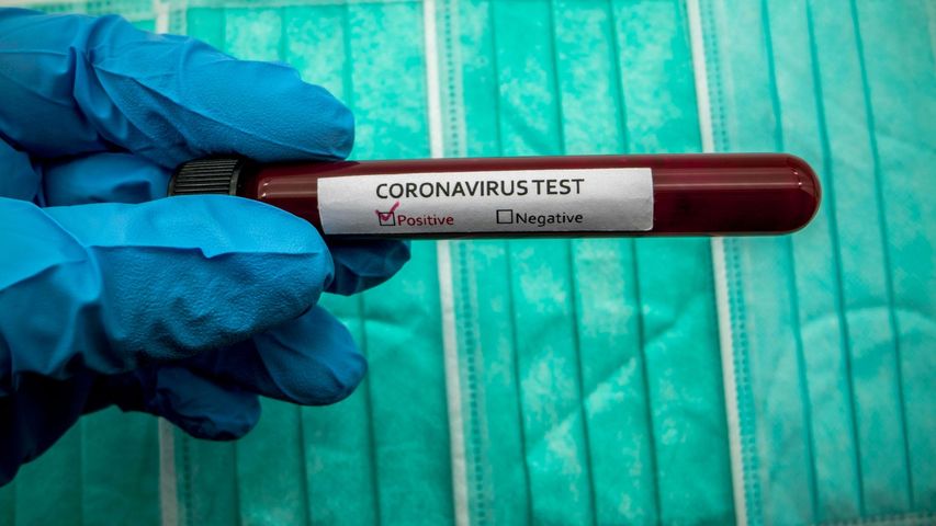 Koronawirus SARS-CoV-2 może być wykrywany również w pocie