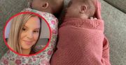 Sugerowali jej aborcję. Urodziła niezwykłe bliźniaczki, przypadek jeden na 2 miliony