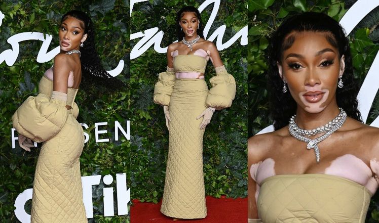Winnie Harlow